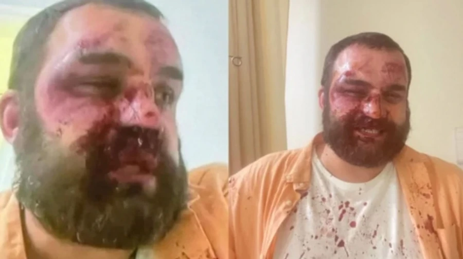 В Грузии нападают на оппозиционных политиков и активистов: по меньшей мере 4 пострадавших