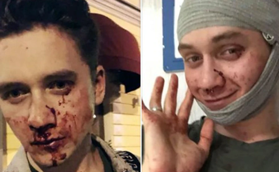 На Подоле неизвестные избили двух парней за ориентацию. Полиция начала производство