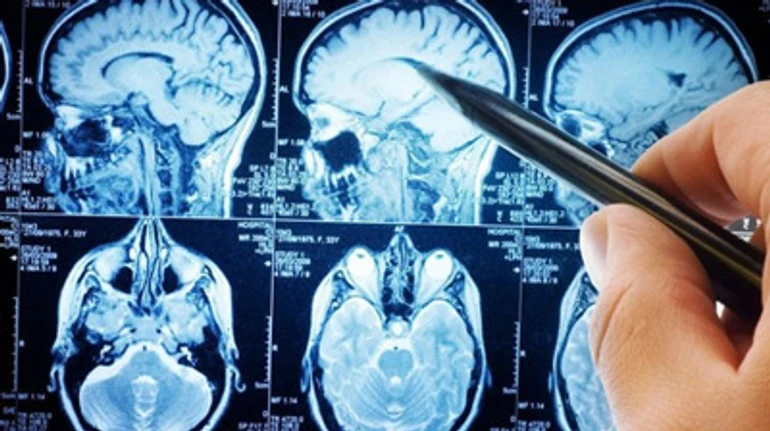 Хвороба, яка завжди повертається. Чи лікується розсіяний склероз