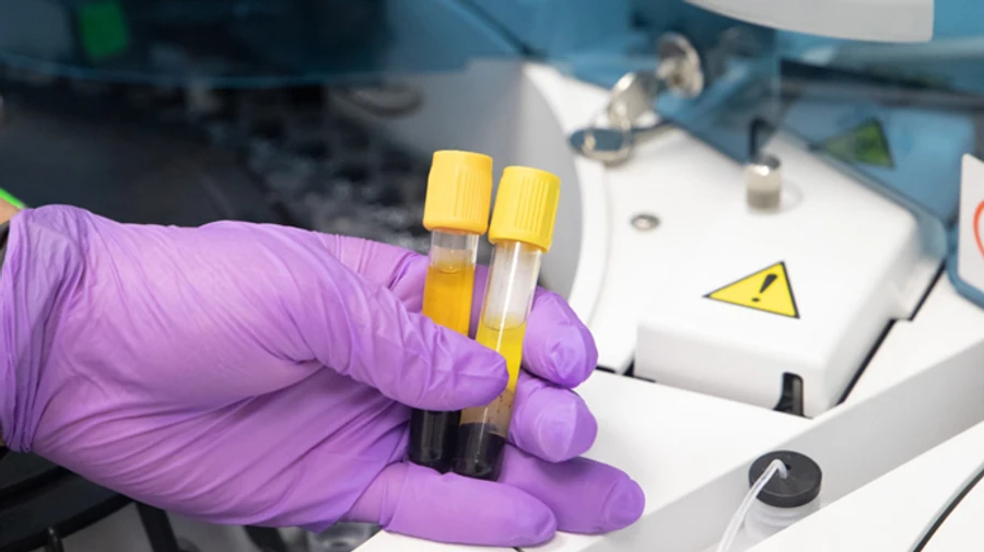 В Киеве за сутки 40 смертей от COVID