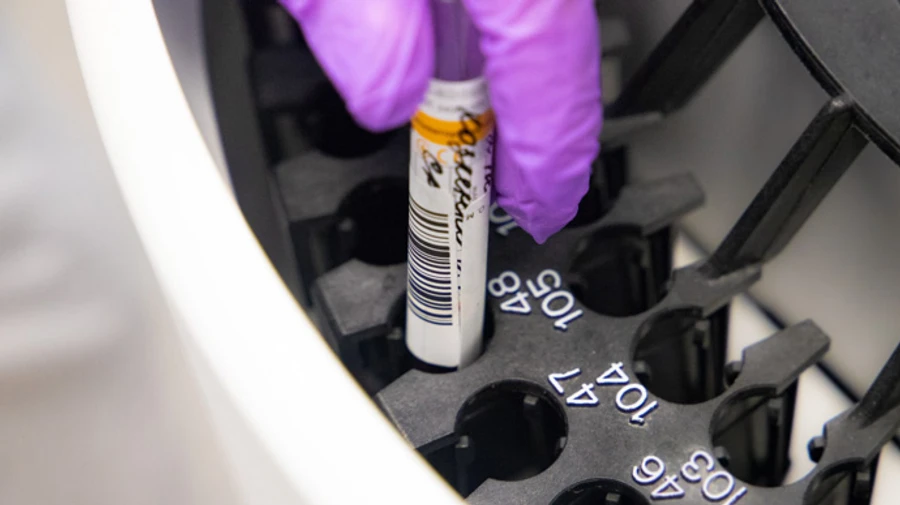 Кличко: В Киеве работает 71 пункт бесплатного тестирования на COVID