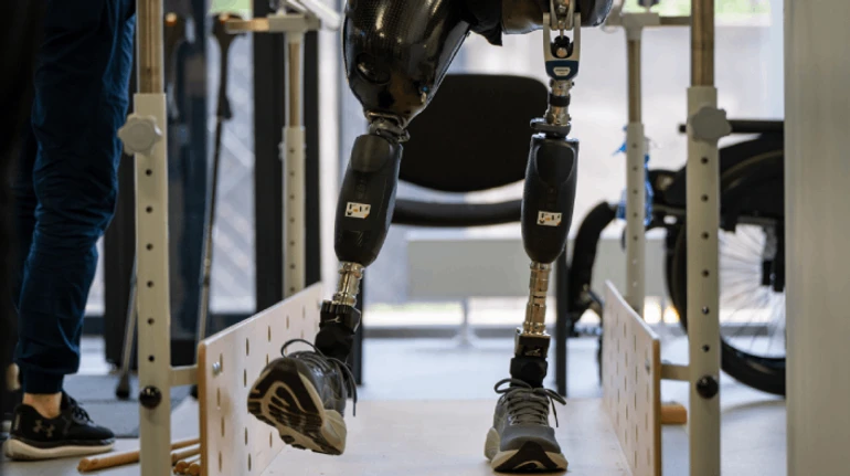 Лише 10% з мільярда. Чому в Україні не використали гроші, виділені на біонічні протези для військових