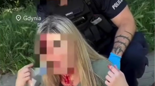 У Польщі затримали чоловіка, який побив українку в Гдині