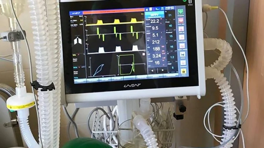 Із 2700 апаратів ШВЛ зараз використовується 170 – МОЗ