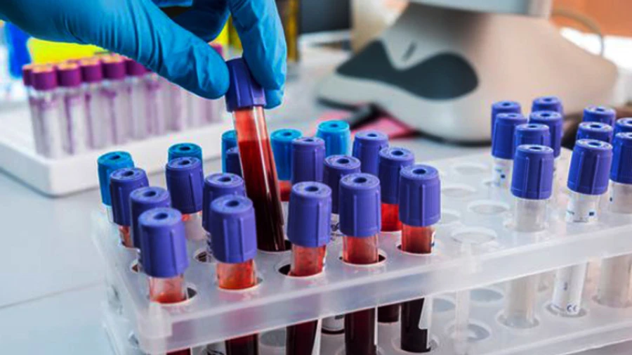 Шесть пациентов с COVID-19 умерли в Беларуси за сутки, заразились 947 человек