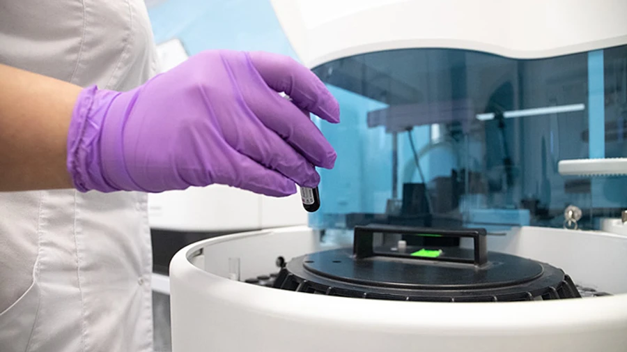 В Киеве за сутки 13 смертей от COVID