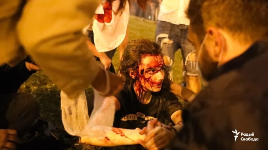 ОМОН в Минске применил резиновые пули против митингующих: есть раненые