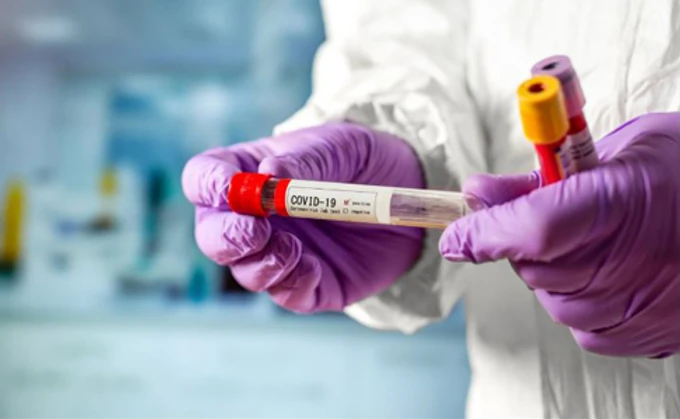 Лікарі діагностували 110 тисяч нових випадків COVID-19