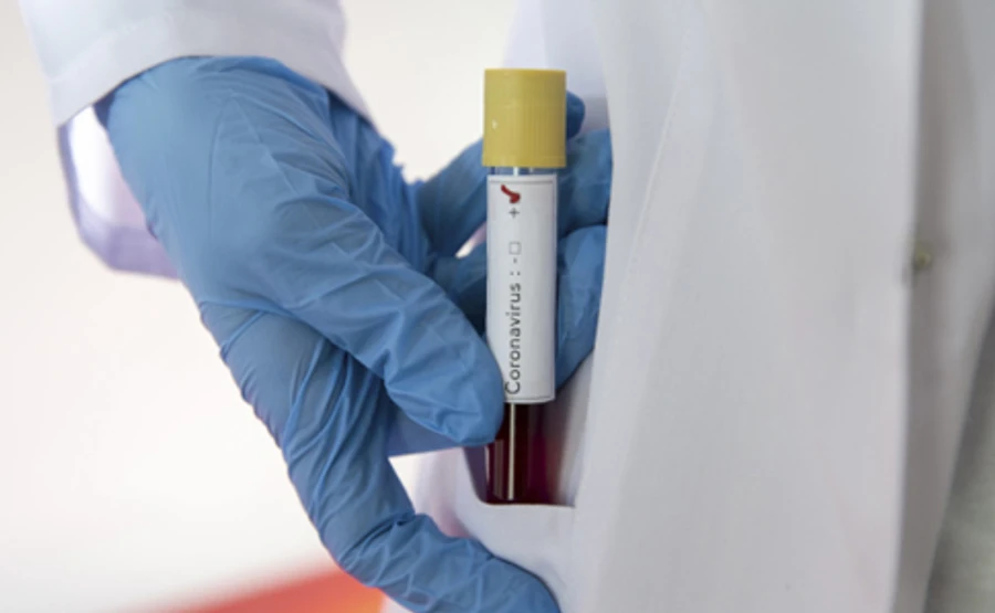 Другу смерть від коронавірусу в Україні розслідуватиме поліція