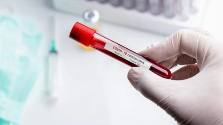 Новини 7 серпня: коронавірусні антирекорди, справа Коломойського