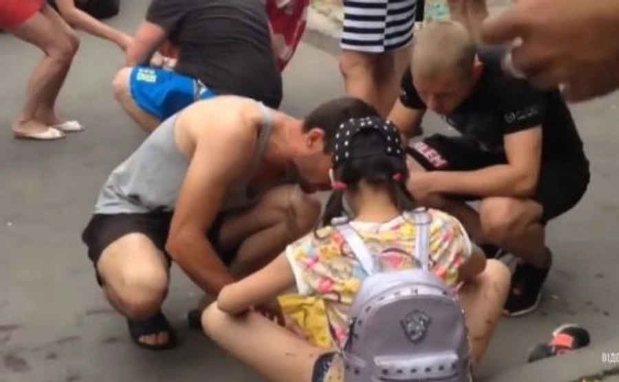 Врачи рассказали о состоянии детей, пострадавших от взрыва в авто