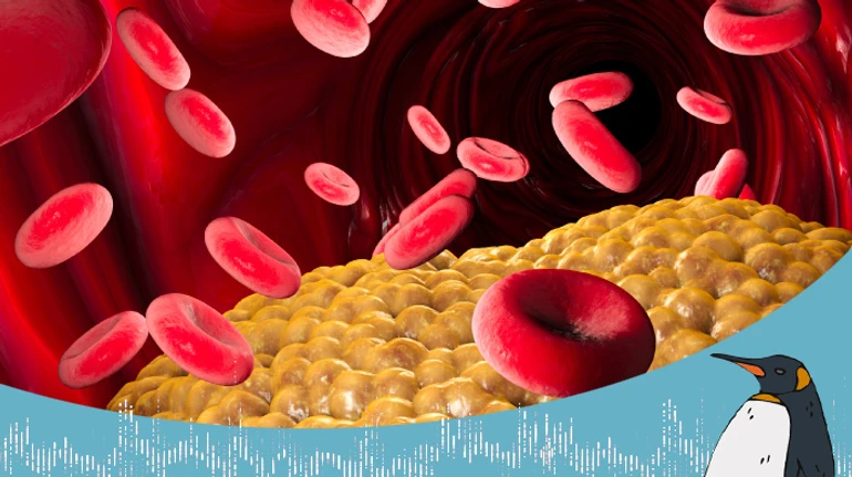 Плохой и хороший парни. Или, что нужно знать о холестерине. Беседа с кардиологом