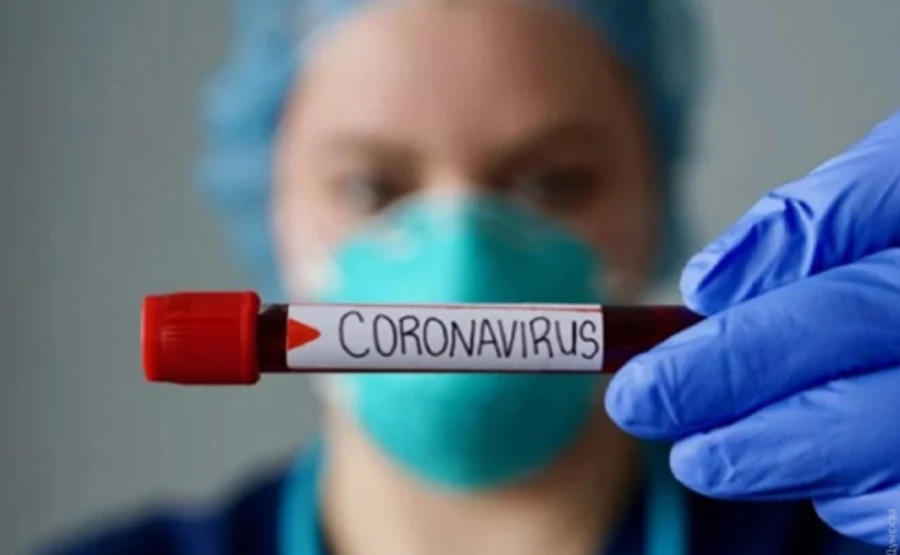 Больных COVID-19 стало больше на 26 человек, зафиксирован 1251 случай — ЦОЗ