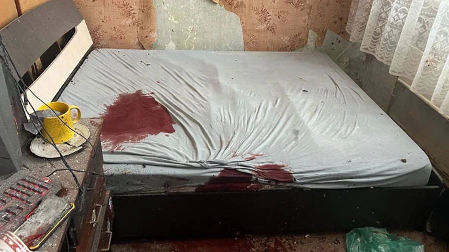 На Київщині хлопець приніс додому знайдену гранату – і мало не загинув