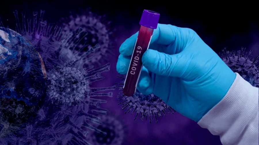 Україна опустилася на 13 місце у світі за поширеністю COVID-19 