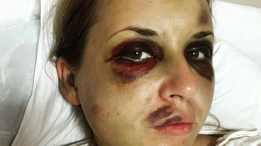 У жінки, яку побили в потязі, погіршився стан здоров’я