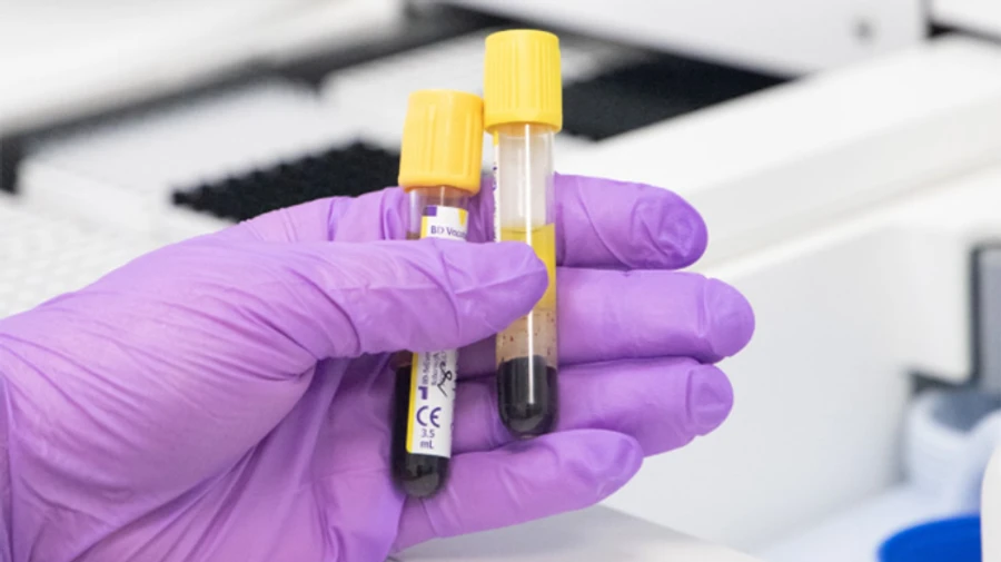 У Києві після вихідних різкий стрибок хворих на Covid