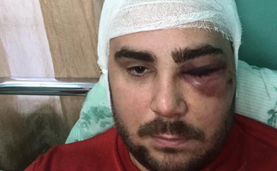 У Запоріжжі підстрелили одного з керівників Автоєвросили