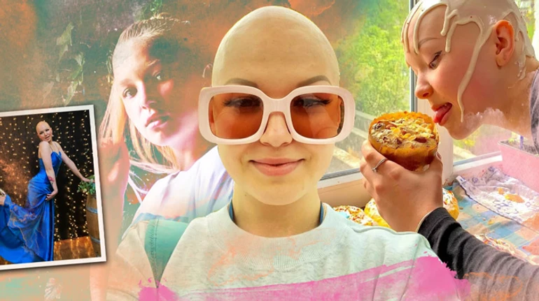 Перевоплощалась в Еву, которую не знаю. История девушки, которая облысела после стресса из-за пожара в летнем лагере