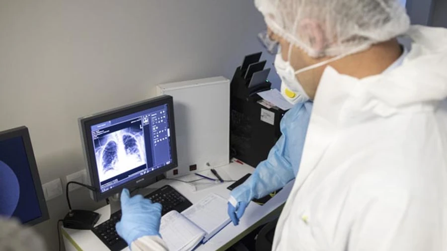 Стало известно, сколько украинцев заболели на COVID-19 повторно