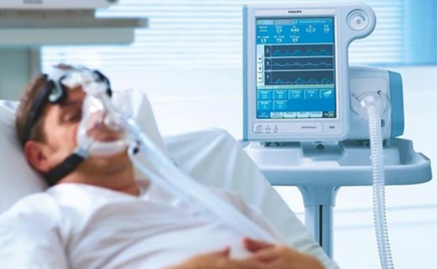 Лікарням обіцяють вітчизняні апарати штучної вентиляції легень у найближчі тижні