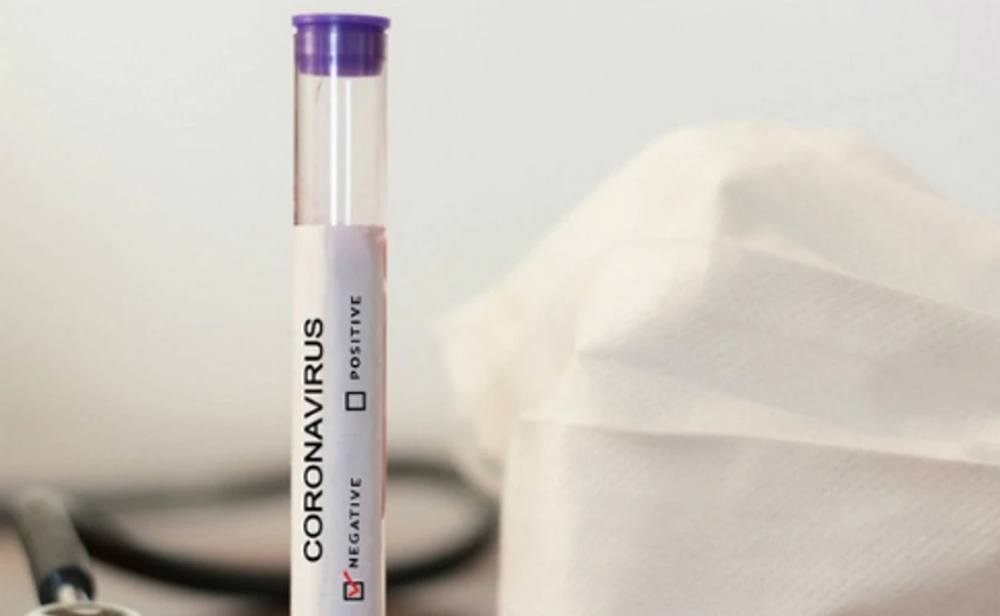 Еще трое украинцев побороли коронавирус – ОГА