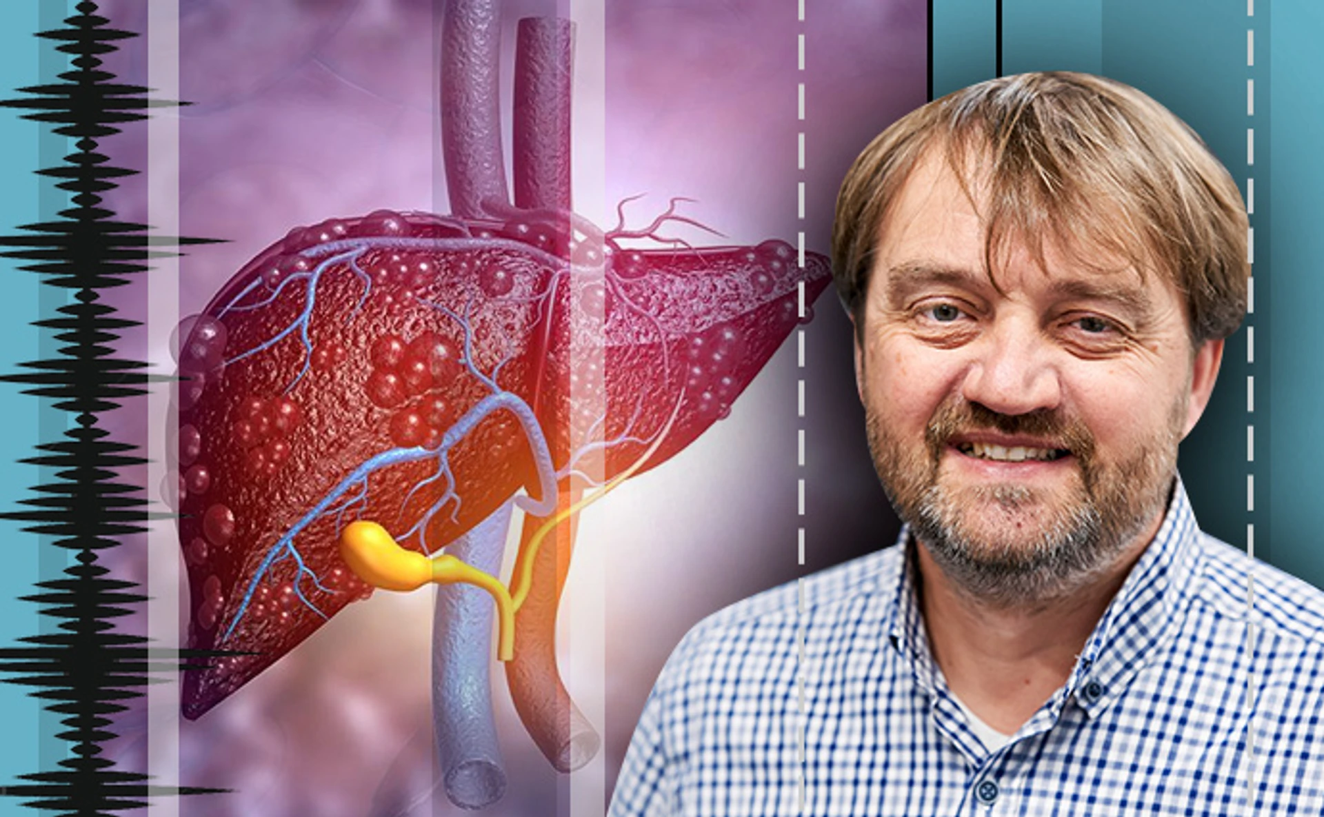 А, В, С… Про все різноманіття вірусних гепатитів – з інфекціоністом Федором Лапієм