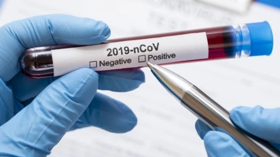 Минздрав назвал топ-3 областей, где коронавирус распространяется быстрее всего