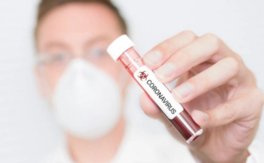 В Украине 942 человека заболели COVID-19, из них 23 умерли