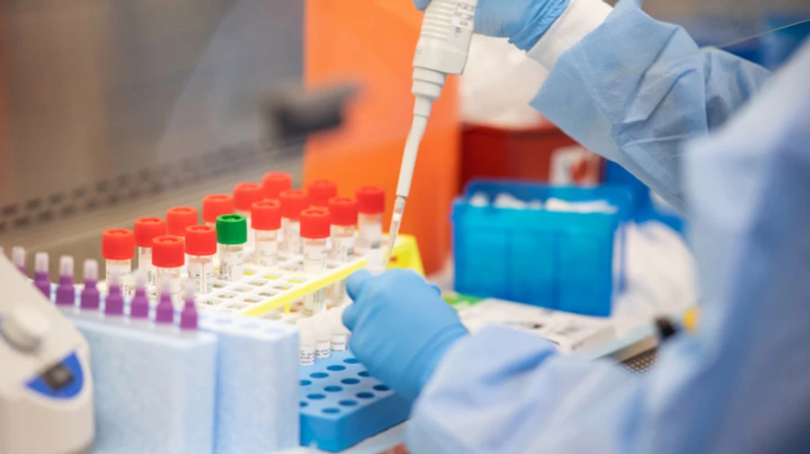 Искажению результатов тестов на COVID-19: в Днепре уволили руководителя лабцентра