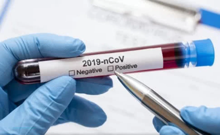 У Білому домі кажуть про можливі 240 тисяч смертей від коронавірусу у CША