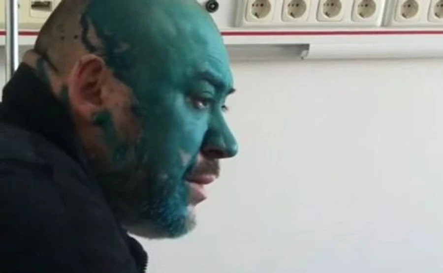 Крисіну в Інституті серця хлюпнули зеленкою в обличчя