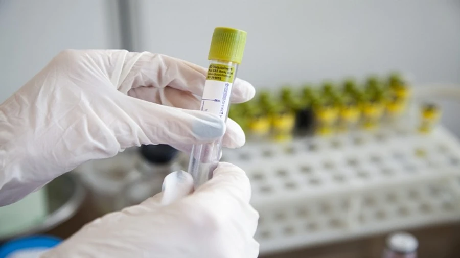 В Украине коронавирус унес жизни более 40 тысяч человек