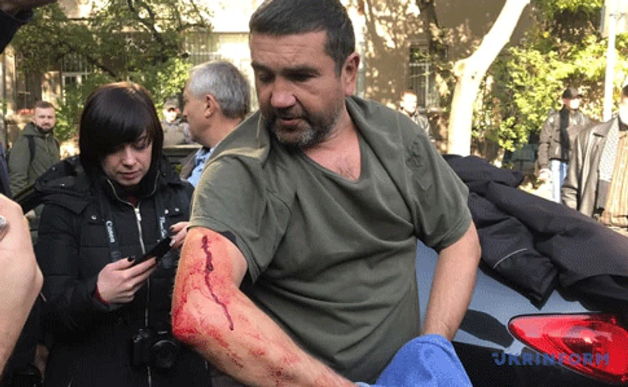 Під МВС затримали чоловіка, який облив журналістку кефіром – поліція