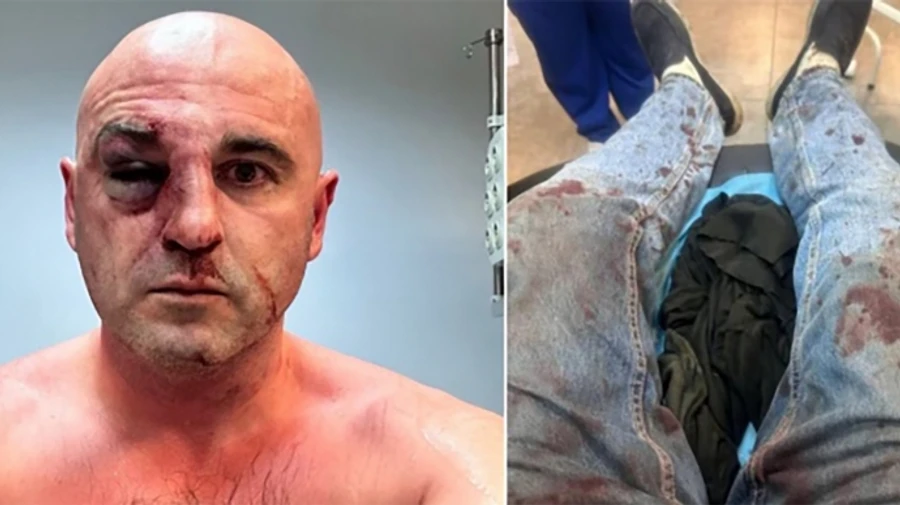 Protest in Georgia: opposition leaders beaten in Tbilisi – video