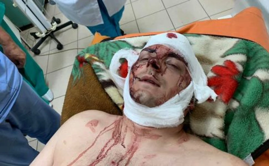 Екс-мера Конотопа, який балотується в Раду, побили