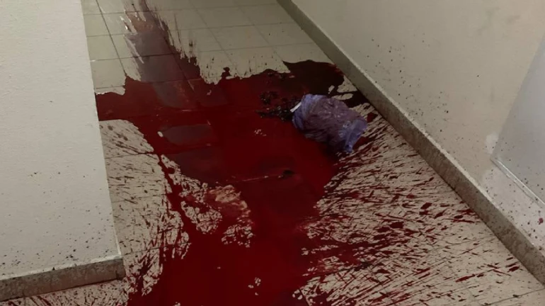 Облитий кров'ю під'їзд, розбите авто: в АРМА скаржаться на тиск