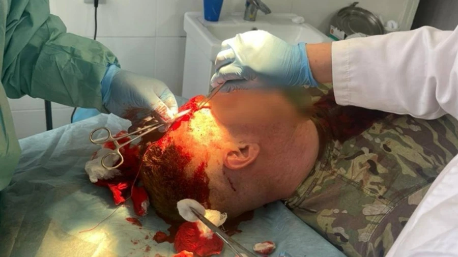 На Закарпатті місцеві жителі напали на прикордонників: є постраждалі