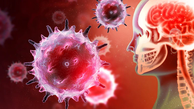 Туберкульозний менінгіт: як розпізнати та правильно лікувати смертельно небезпечну хворобу