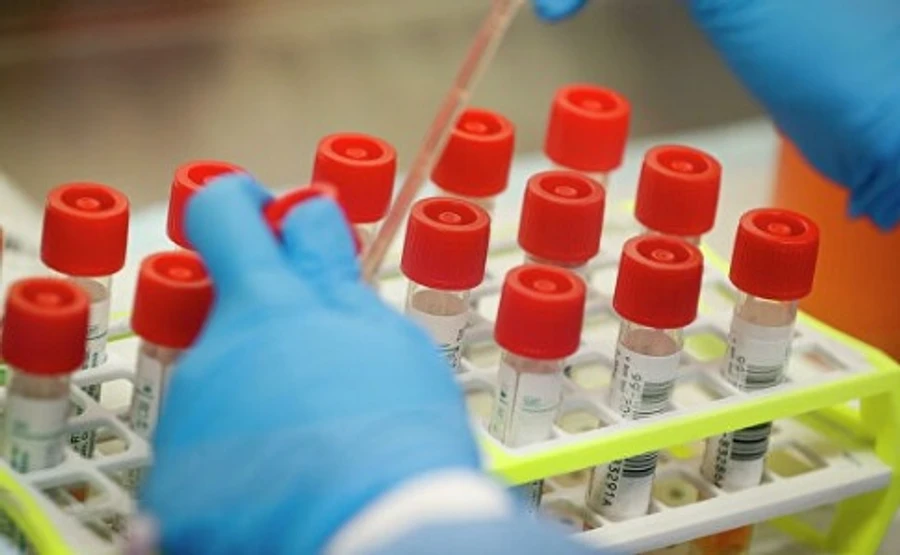 В США зарегистрировали более 20 тысяч летальных случаев от COVID-19