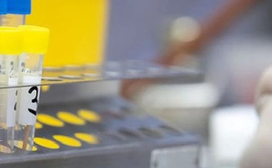 Во Львове начали делать тесты на иммунитет к коронавирусу