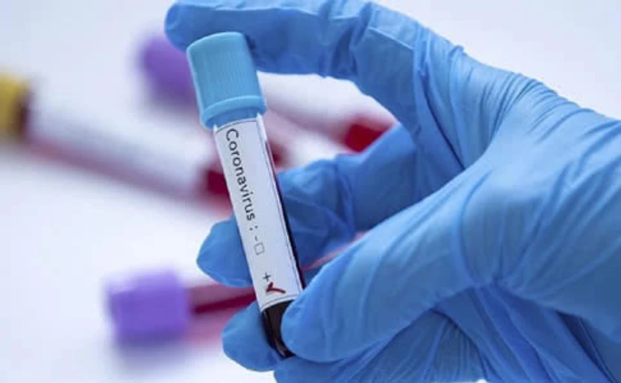 От осложнений, вызванных коронавирусом умерло 14 641 человек