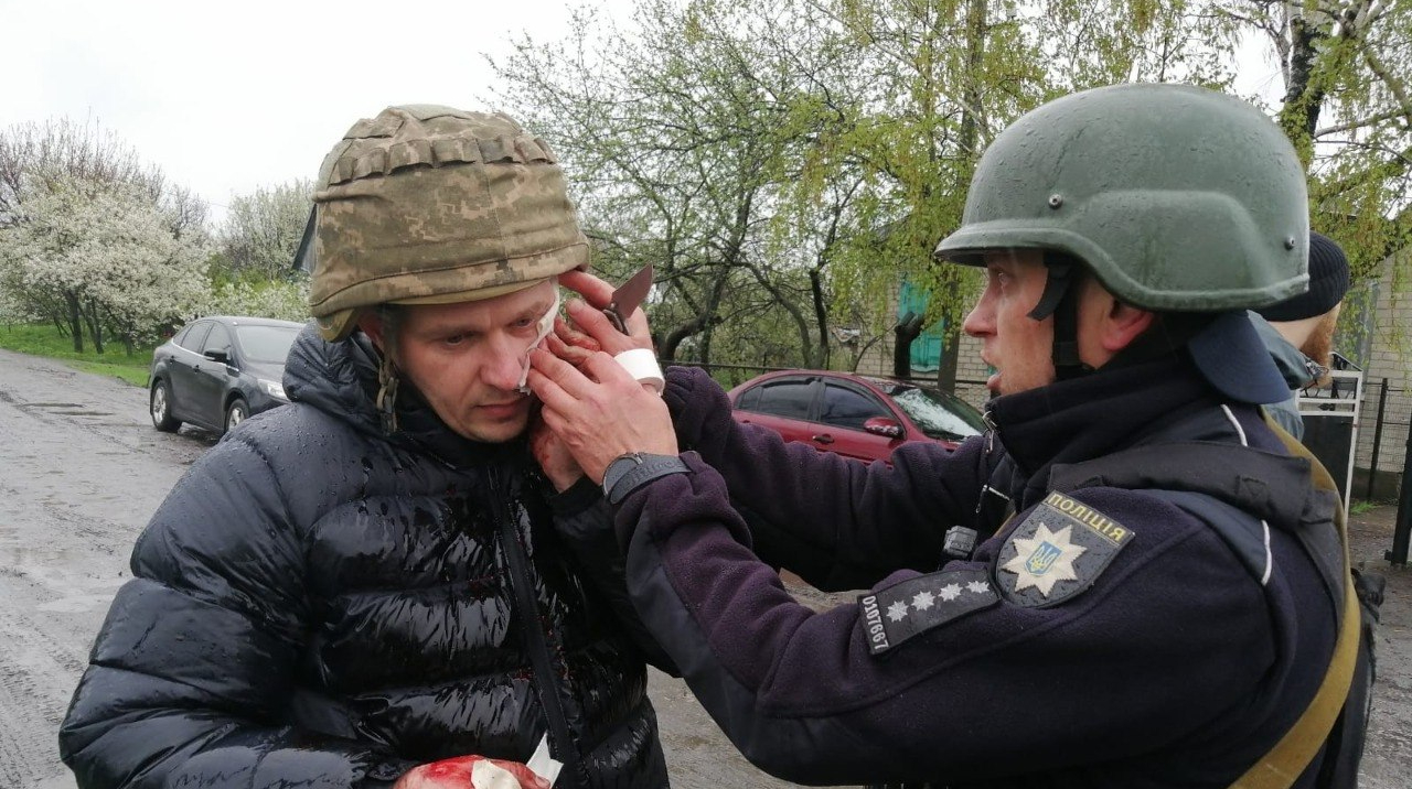 A man threw grenades at police officers in Dnipropetrovsk region during his arrest and injured five