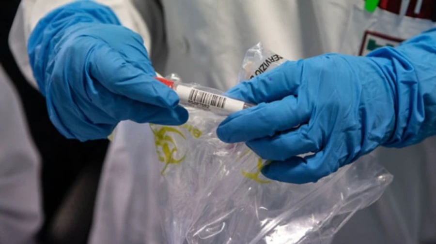 Велика частка негативних ПЛР-тестів можуть бути хибними – МОЗ