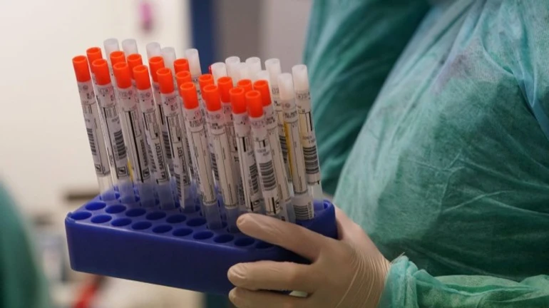 В Україні виявили ще 9432 зараження коронавірусом, 147 людей померли