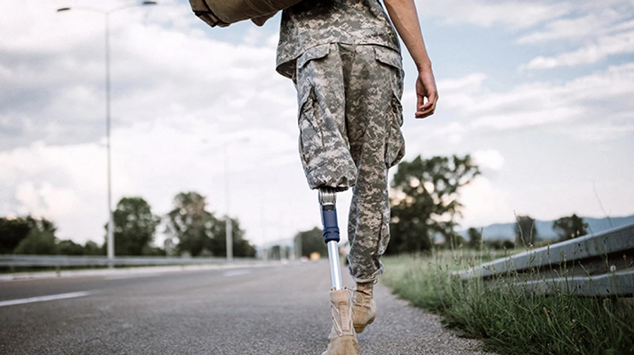 Масштаби ампутацій в Україні сягнули рівня Першої світової війни – WSJ