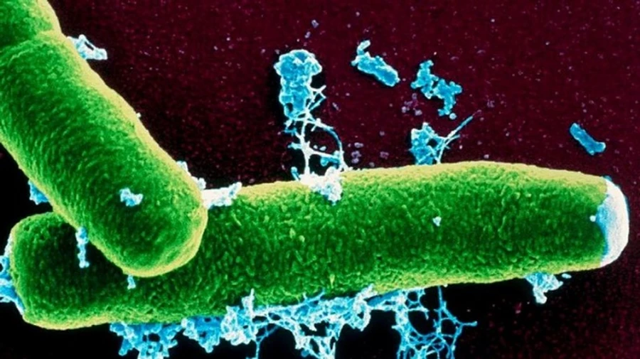 У Росії знову виявили випадки сибірської виразки