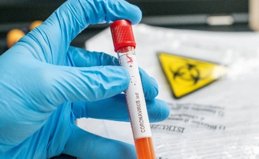 США протестували на коронавірус понад 6 мільйонів осіб