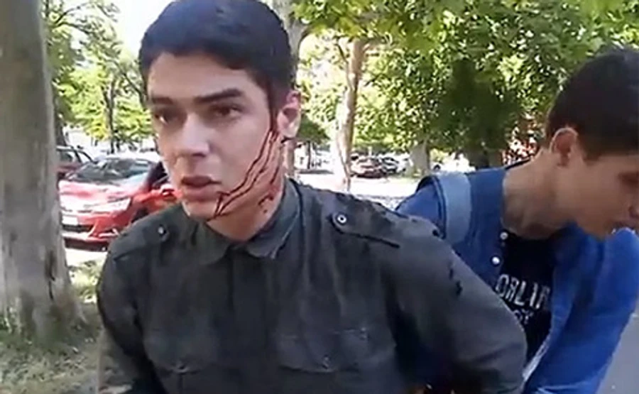 В Одесі поранили ножем лідера місцевого Автомайдану