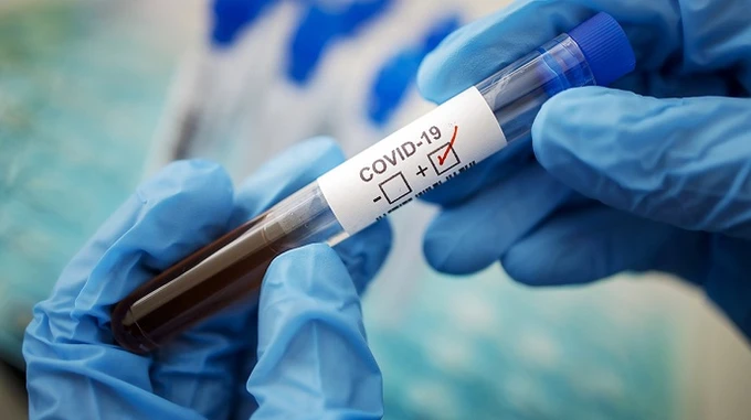 У світі — майже 700 тисяч випадків COVID-19, найбільше в США